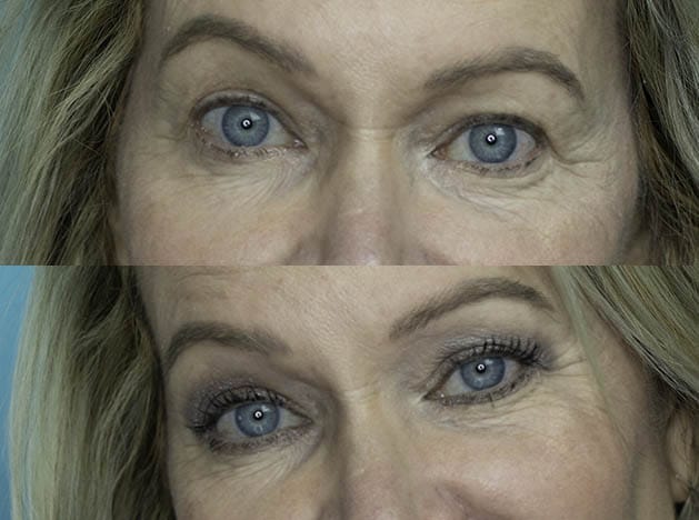 Easy One Eyeshadow Eye Makeup for Older Hooded Eyes 27 Easy One Eyeshadow Eye Makeup for Older Hooded Eyes 27
